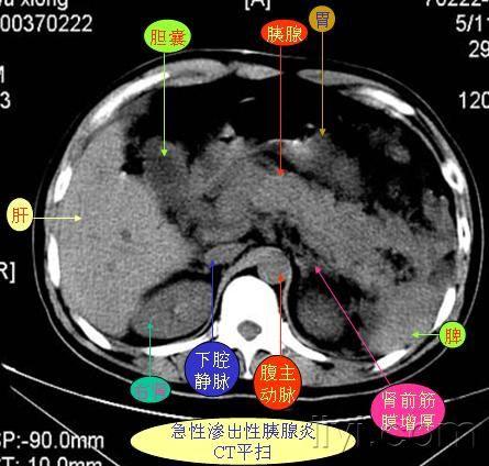 资料大全正版资料免费,准确资料解释定义_CT77.98